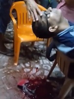 Murder Victim Dripping Blood as People Gawk