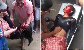 Beautiful Girl Stabbed... Turned into Bloody Mess