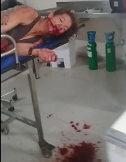 Chick Stabbed in the Mouth Bleeding Out