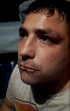 Prisoner Gets His Mouth Sewed Shut (Chile)