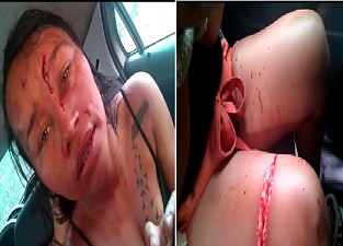 Girl Kidnapped and Slashed For Cheating On Cartel