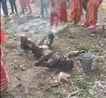Young Girl Sets Herself on Fire (Aftermath)