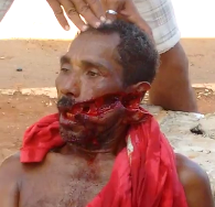 Man with a face disfigured by a machete