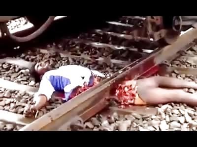 Man split in half by a train still alive