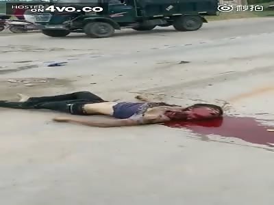 Man Almost Beheaded In Traffic Accident
