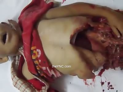  Another Child Martyr Ripped To Pieces City Of Aleppo