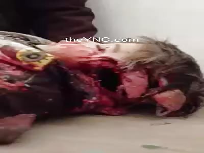 The child Martyr Bombings In Aleppo, Syria