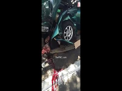 Man Dies In Brutal Run Over By A Car