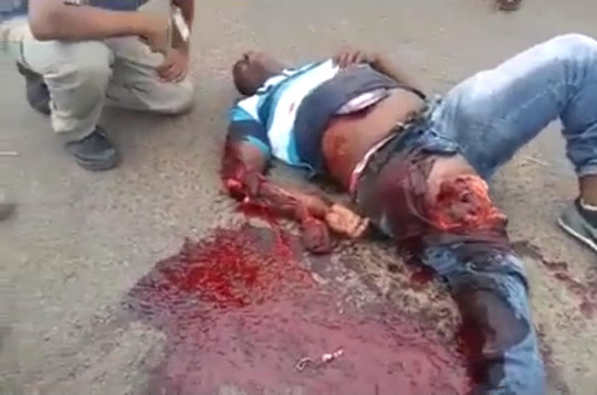 Motorcyclist Man With His Leg And Arm Ripped In Accident
