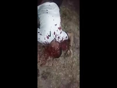 The Man Was Killed By A Shotgun Blast To His Face