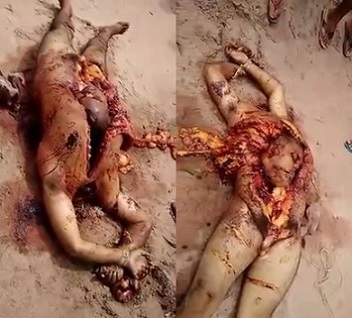 AFTERMATH of Penis Cut Off Video: Tied Up Man Was Opened the Middle an His Head Placed Inside the Body