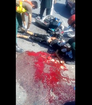 (Better Quality) Young Motorcyclist Died With his Skull Smashed on the Pavement