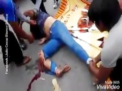 Man and Woman Crash on Motorcycle in Peru, Woman Gets All Attention, Man None