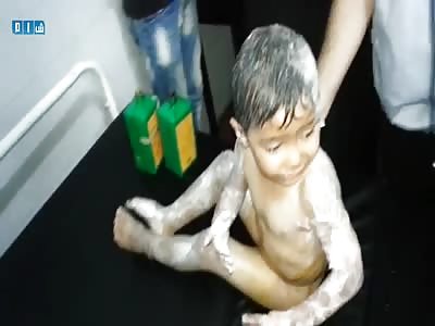 WAR IS WAR: CHILD IN SHOCK AFTER BEING BURNED IN BOMBING