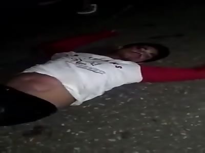 SOME BRUISES IN AN ACCIDENT