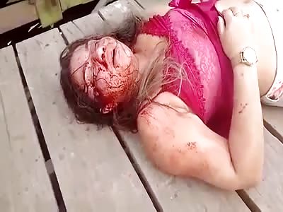 GIRL DYING AFTER SHOT IN THE FACE