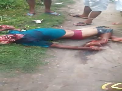 Man Had His Face Destroyed by Machete Blows
