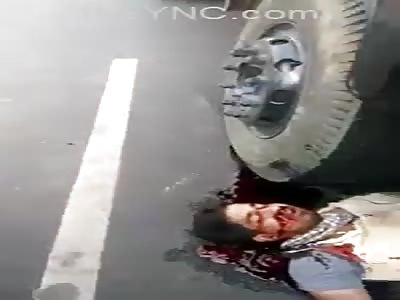 Man Agonizes In Accident