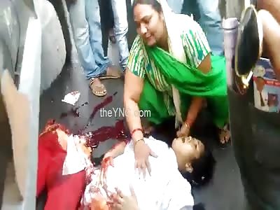 SHOCKING: Woman split in two still Alive (OTHER ANGLE) 