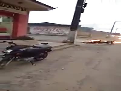  burns on his motorbike