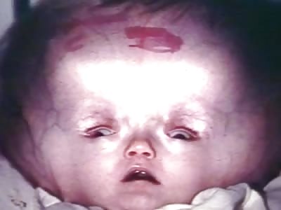 Gruesomely Malformed Babies   (copilation)