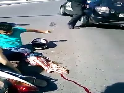 Motorcycle rider loses leg