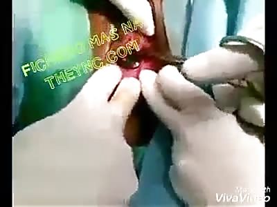 Taking a bulb out of a vagina