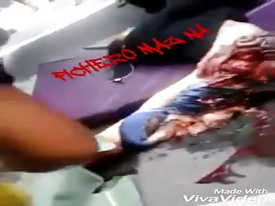 Woman torn apart by truck  