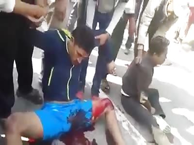 Man breaks his testicles