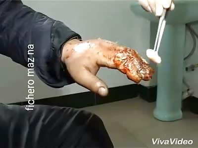 Man can no longer masturbate