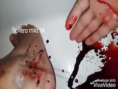 man's foot draws blood as if it had a hose inside