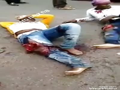 accident leaves a man with a beautiful wound