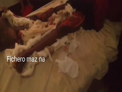 MAN WITH THE CARCOMIDES FEET