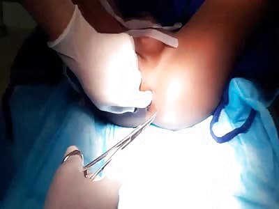 PHYSICIANS PULL NEEDLE FROM HER PATIENT BACK