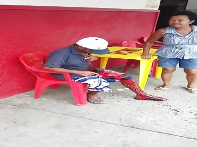 MAN WITH BLEED WOUND