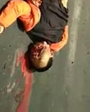 Ready for the Disguises Party after accident .