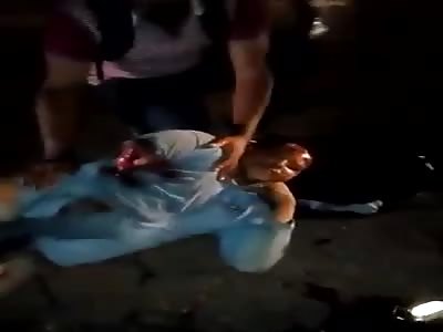 Man with Arm Ripped Clean off is in a Complete State of Shock