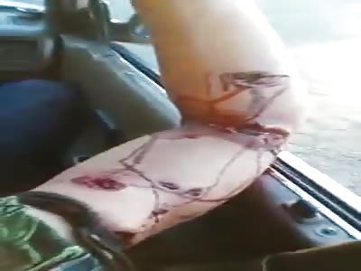 WOUNDED HAND OF MORDIDA DE LEÃ“N