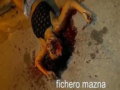 Poor Woman Shot in the Head Bleeds with HUGE Hole in his Forehead