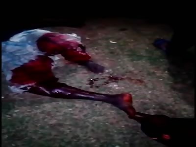 Victim of machete attack in Camaroon.