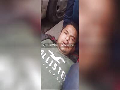 Colombian man fucked up his two legs in traffic accident