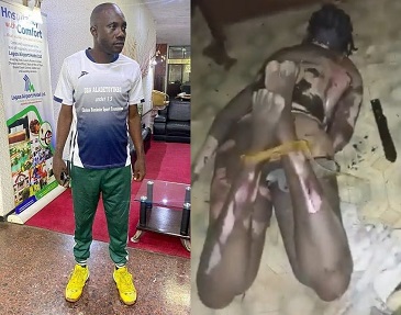 Man Kills Ex Lover With Hot Water and Removes Her Intestines