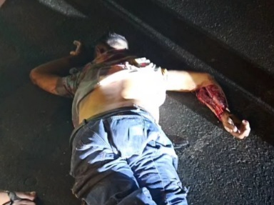 Dead shattered body of motorcyclist lying in street 