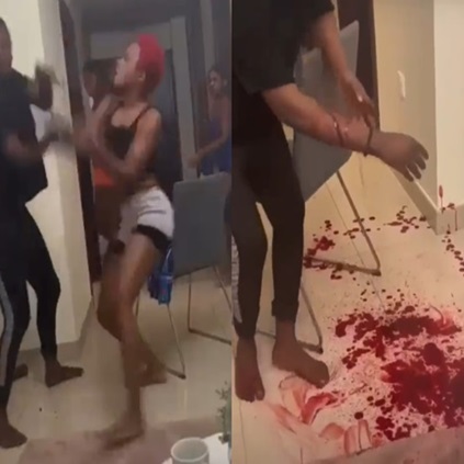 A Woman Deeply Cut Her Friend's Hand During A Fight. 