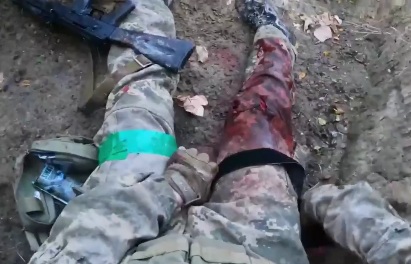wounded Ukrainian soldier calling for a nurse to help him