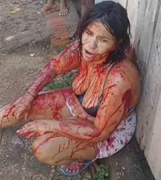 Girl Bleeding After Her BF Prisoned For Killing Previous Wife Stabbed Her Several Times