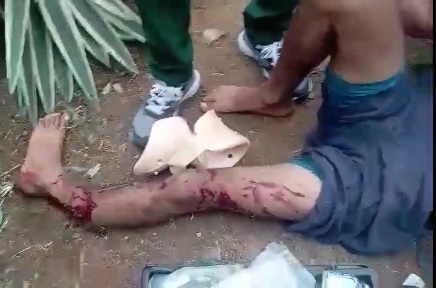 Horrific motorcycle accident leave one dead and one with crashed leg
