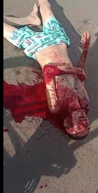 Dude Stabbed in the Throat, Bleeds Out in the Street..