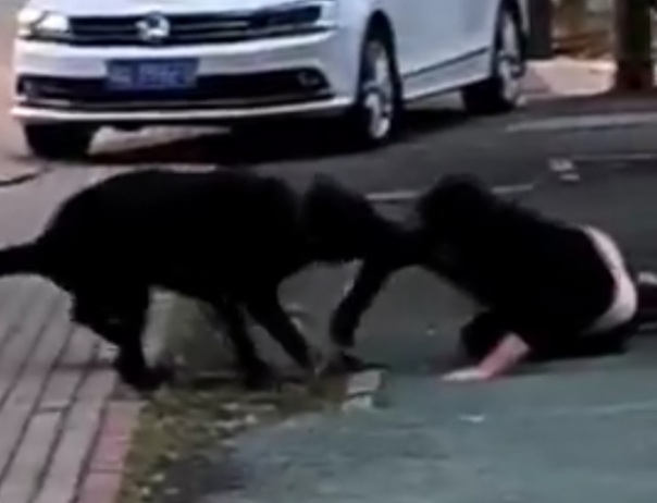 Poor Woman Horrifically Attacked by Dog