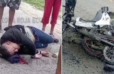 Horrific motorcycle accident leave motorcyclist in intensive care 